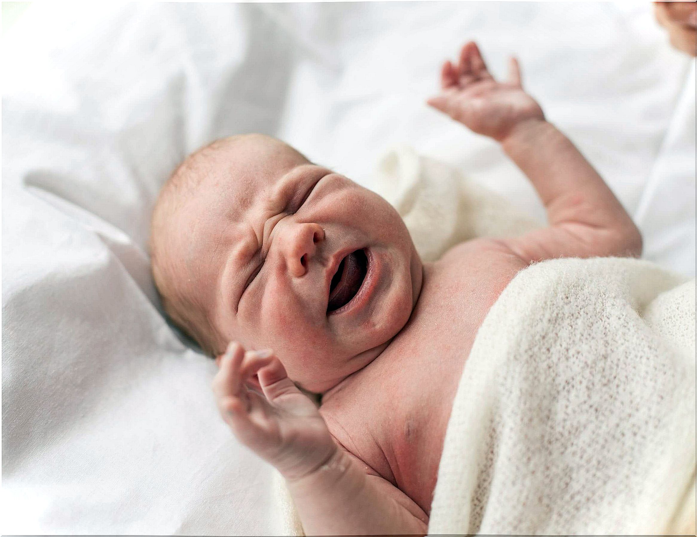 Baby with pimples on his face.