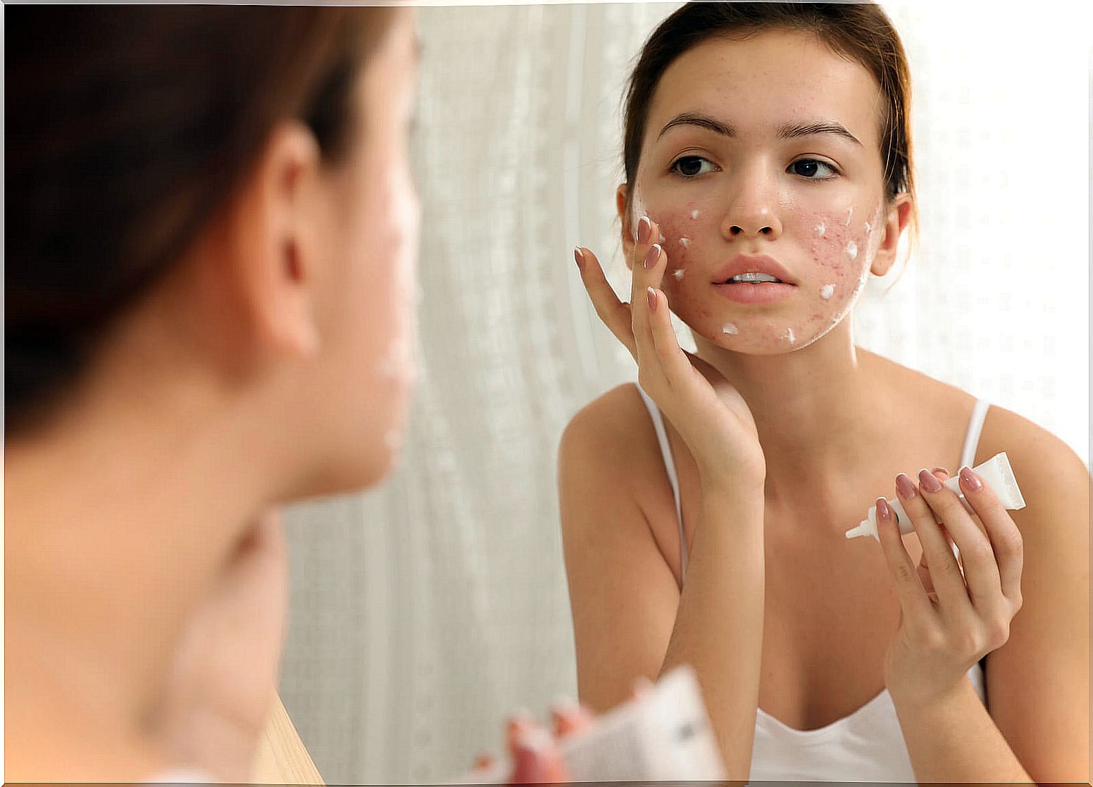 The most common skin problems in adolescents